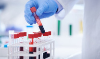Blood test
